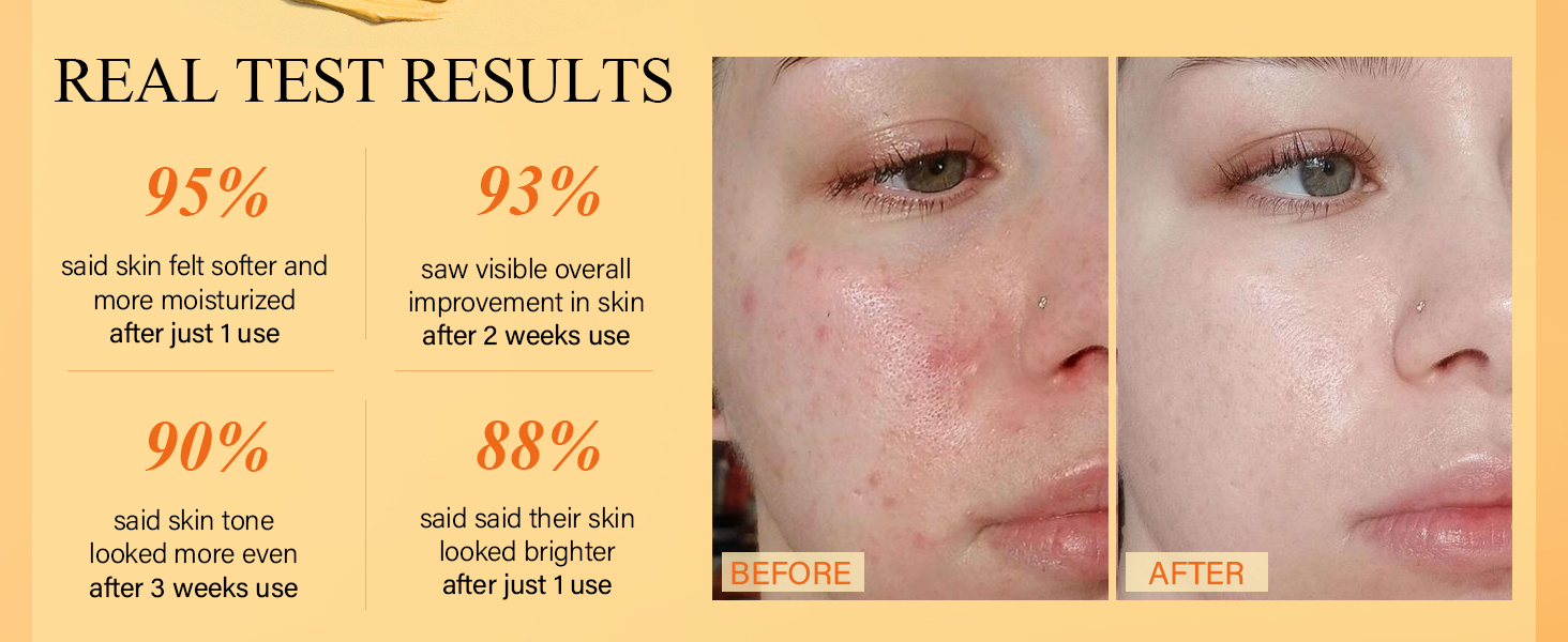 vc clay mask