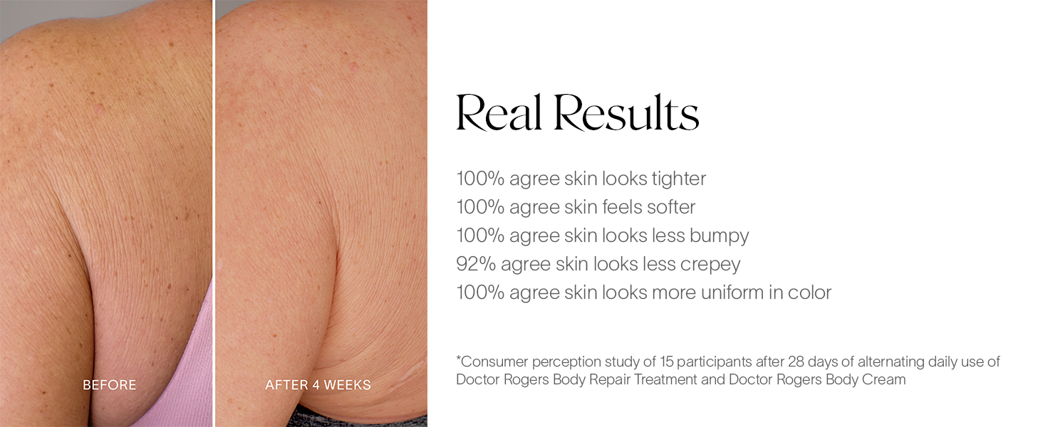 Before & After Results