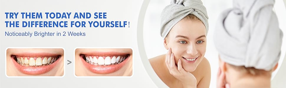 teeth whitening strips