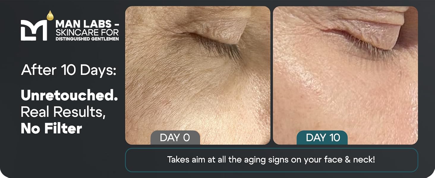 After 10 Days: Unretouched. Real Results, No Filter.