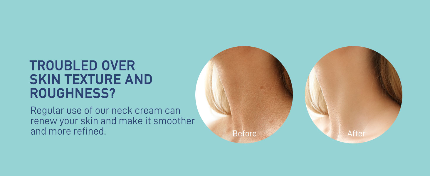 trouble over skin texture?