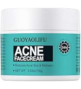 Cystic Acne Spot Cream
