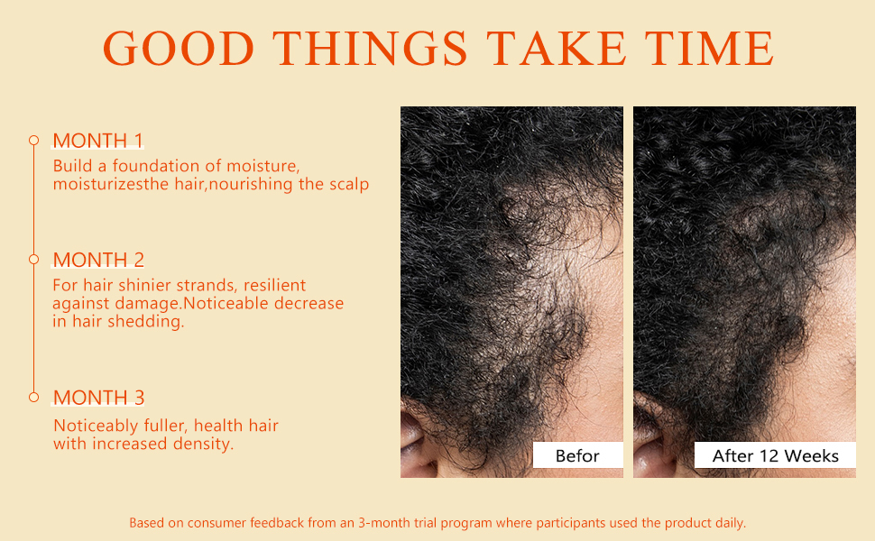 hair growth oil spray for women