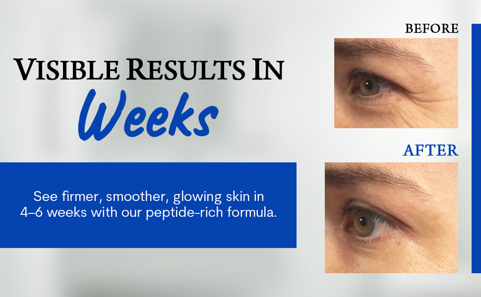 tightener skin care set deep repair reduce wrinkles