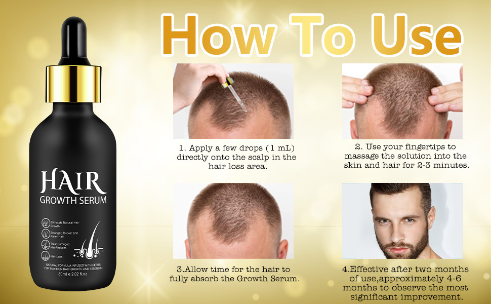 Minoxidil