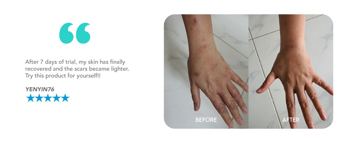 Before and After Image 3