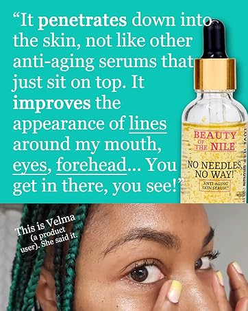 No Needles, No Way! Anti-Aging Serum for Skin-of-Color – Wrinkles Spots Brightens, Evens Tone