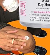 Best Cracked & Dry Heel Foot Cream
