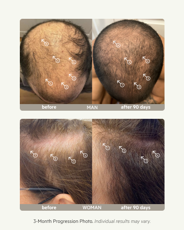 DS Labs Before and After