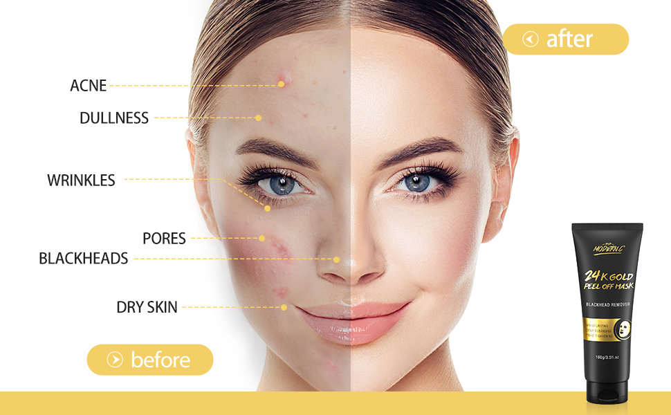 Healthy Skin Has a Perfect Oil and Water Balance