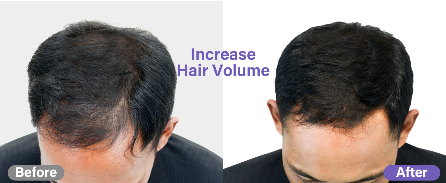 Dry Shampoo Powder for Women & Men
