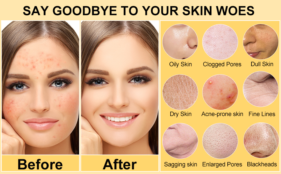 skin care set