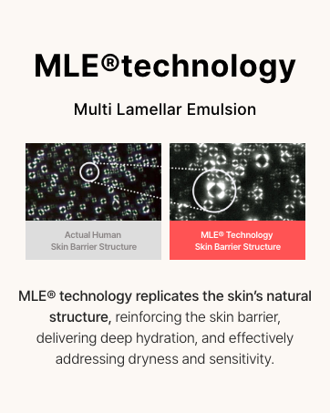 MLE