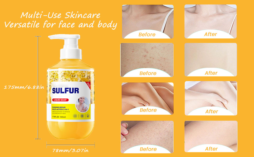 sulfur soap liquid body wash