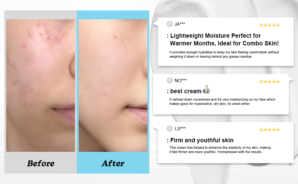 Youthful Formula Ultimate Moisturizing Cream