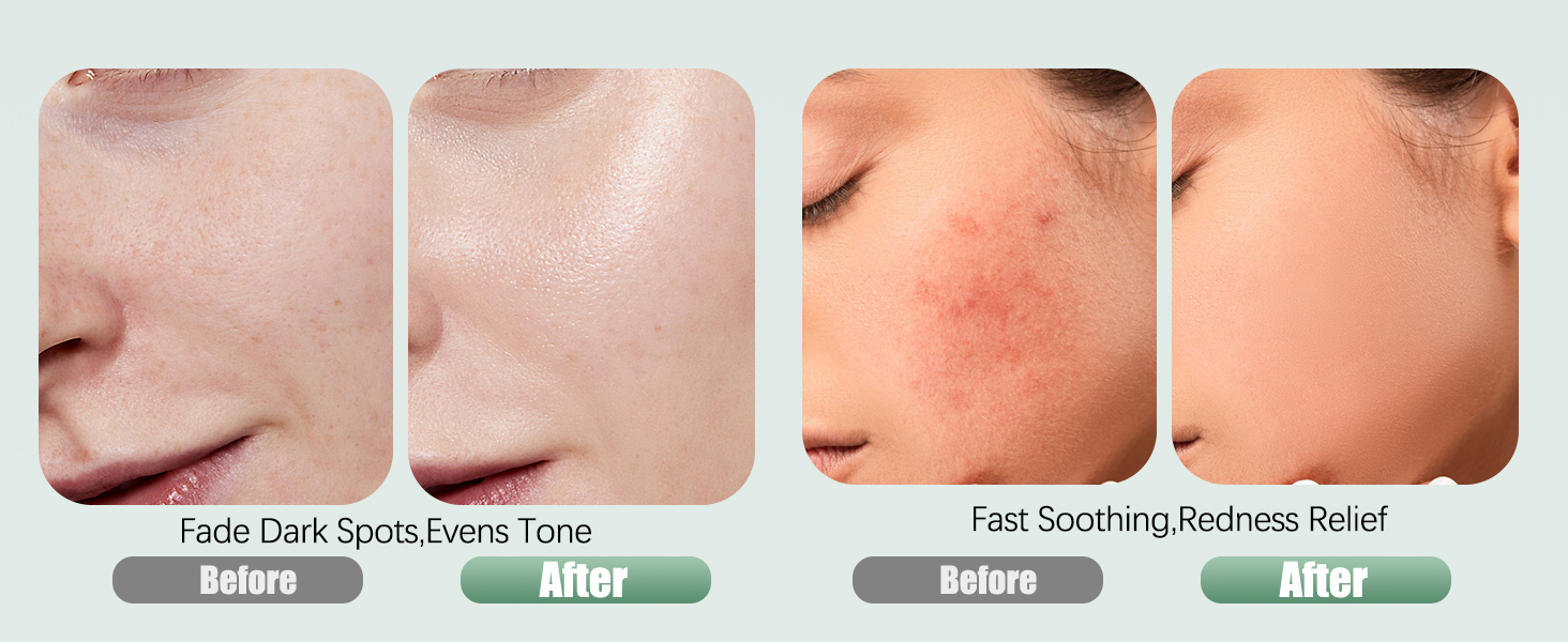 toner pad