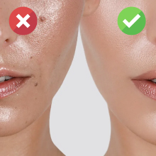 Before and after comparison showing skin improvement with product use