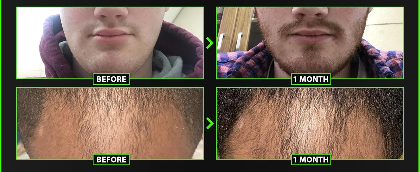 beard balm for men beard conditioner for men minoxidil for beard growth mens beard oil