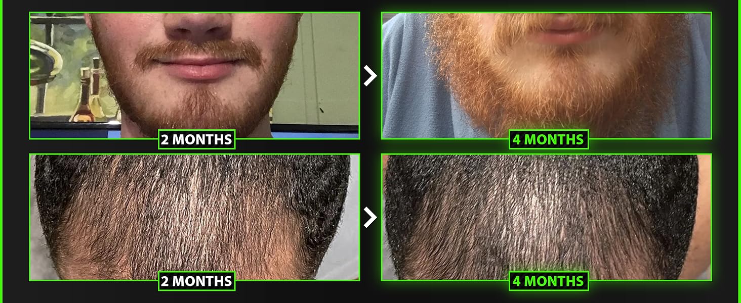 beard thickener for men hair growth oil for black women hair growth oil for men growth oil