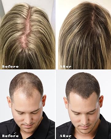 Before and After