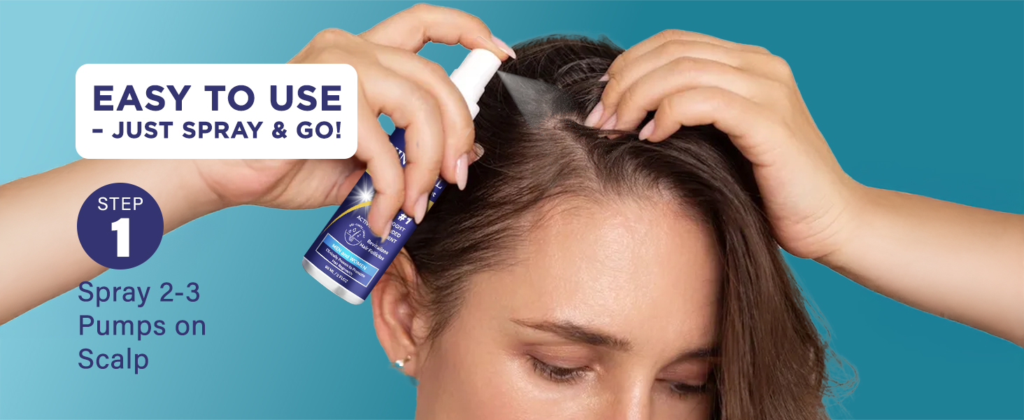 hair loss treatments for women