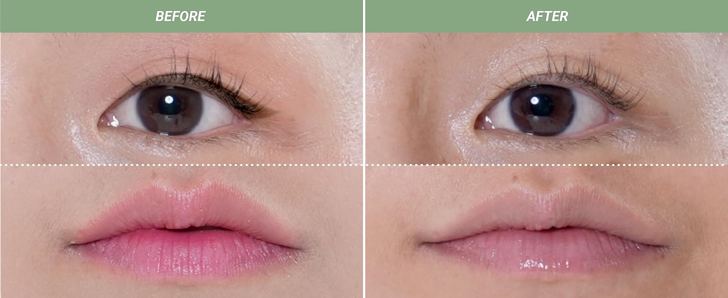 before with makeup face. after cleansed and soothed