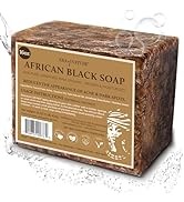 era of nature Best Raw ORGANIC AFRICAN BLACK SOAP, for Dry Skin and Skin Conditions. Pure & Natur...