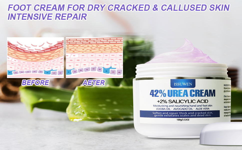 foot cream for dry cracked feet