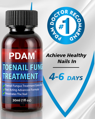 fungus nail treatment toenail fungus treatment toe fungus treatment for toenail