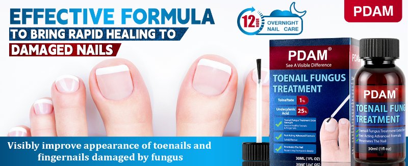 toenail fungus treatment extra strength toe nail fungus treatments nail fungus treatment