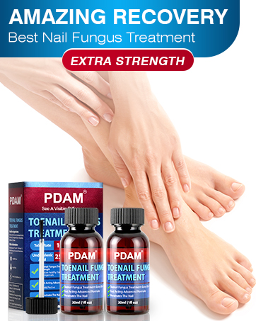 nail fungus treatment toenail fungus nail fungus treatment for fingernails