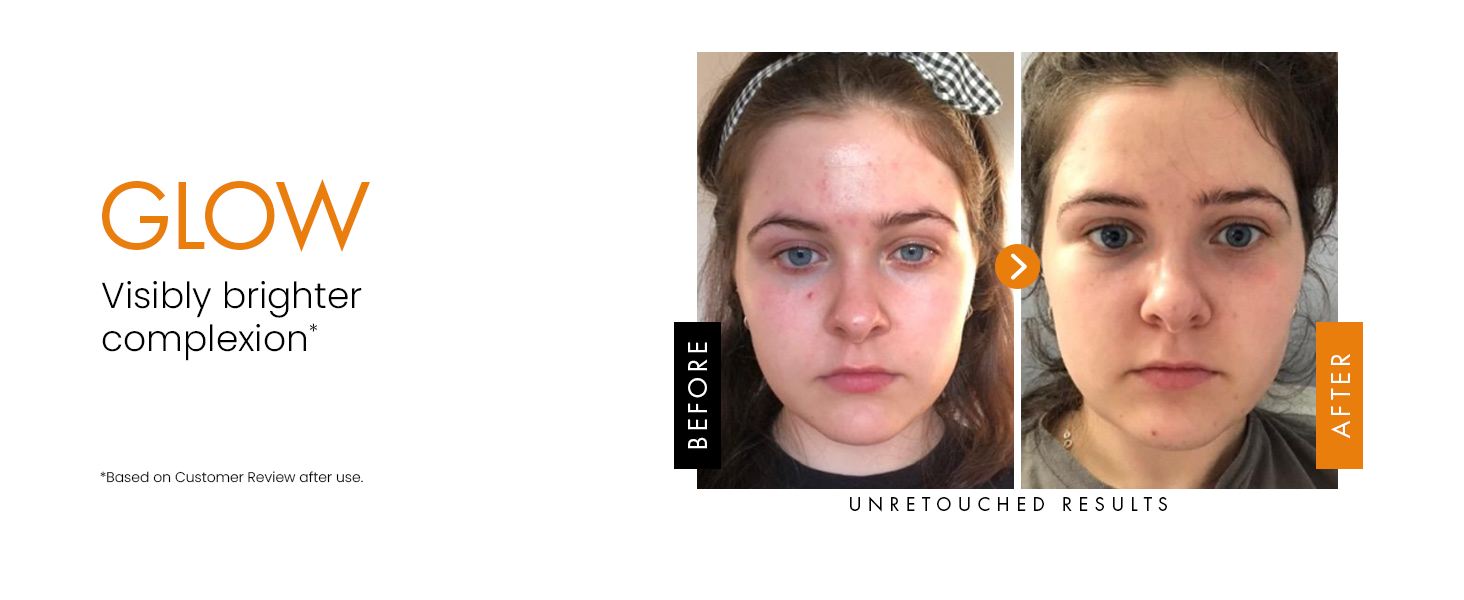 vitamin c serum