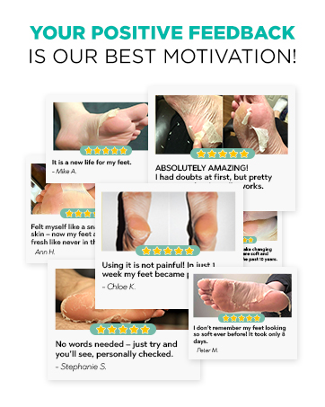 foot mask peel