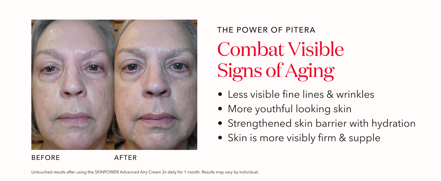 before and after anti aging face cream, anti aging face moisturizer