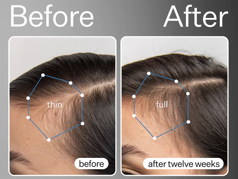 Act+Acre Cold Processed Apple Stem Cell Scalp Serum
