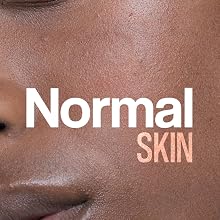 Normal