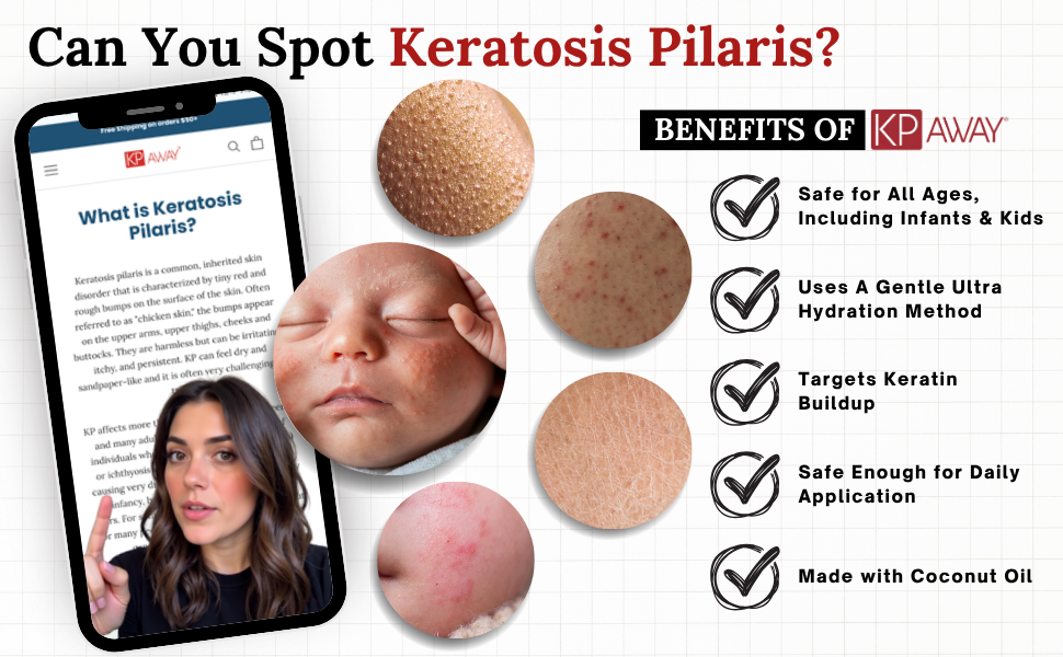 Benefits of KPAway