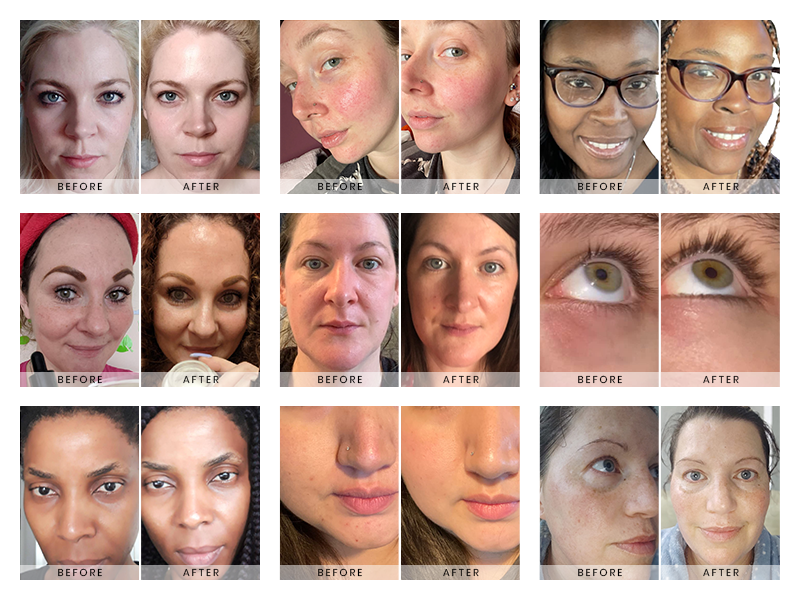 antioxidant serum for face skin serum vitamin e serum vitamin c oil for skin anti wrinkle serum