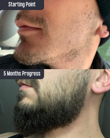 Before and after results