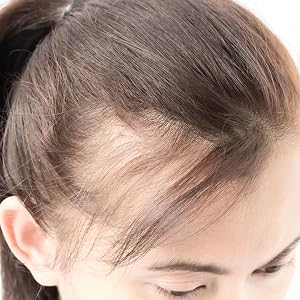 sai zen, anti thinning, anti aging, hair loss, treatment, hair thinning, DHT, cancer, volume 