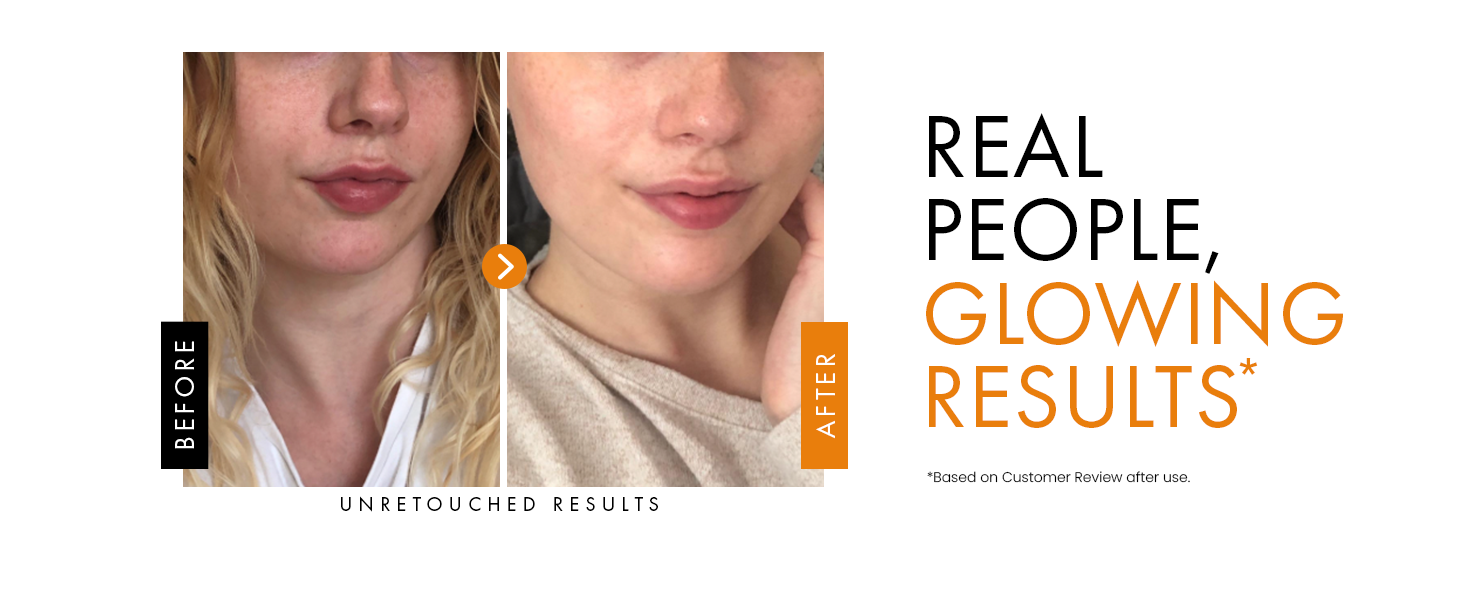 vitamin c serum