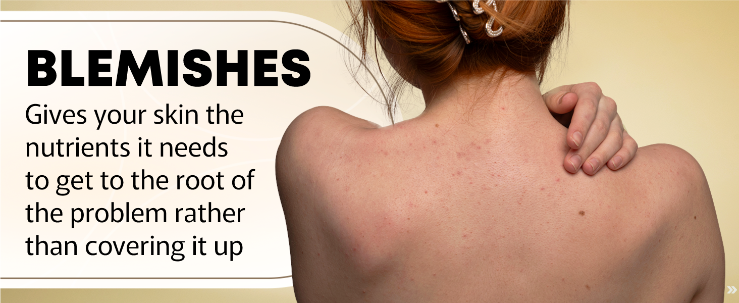 Blemishes