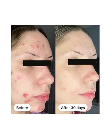 Before and After Use