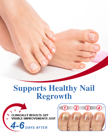 toenail fungus treatment extra strength nail fungus treatment extra strength