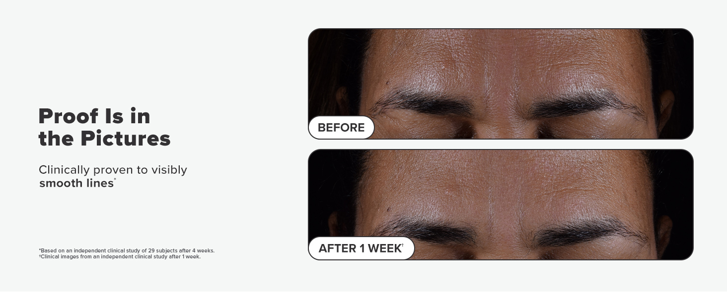 before after 3