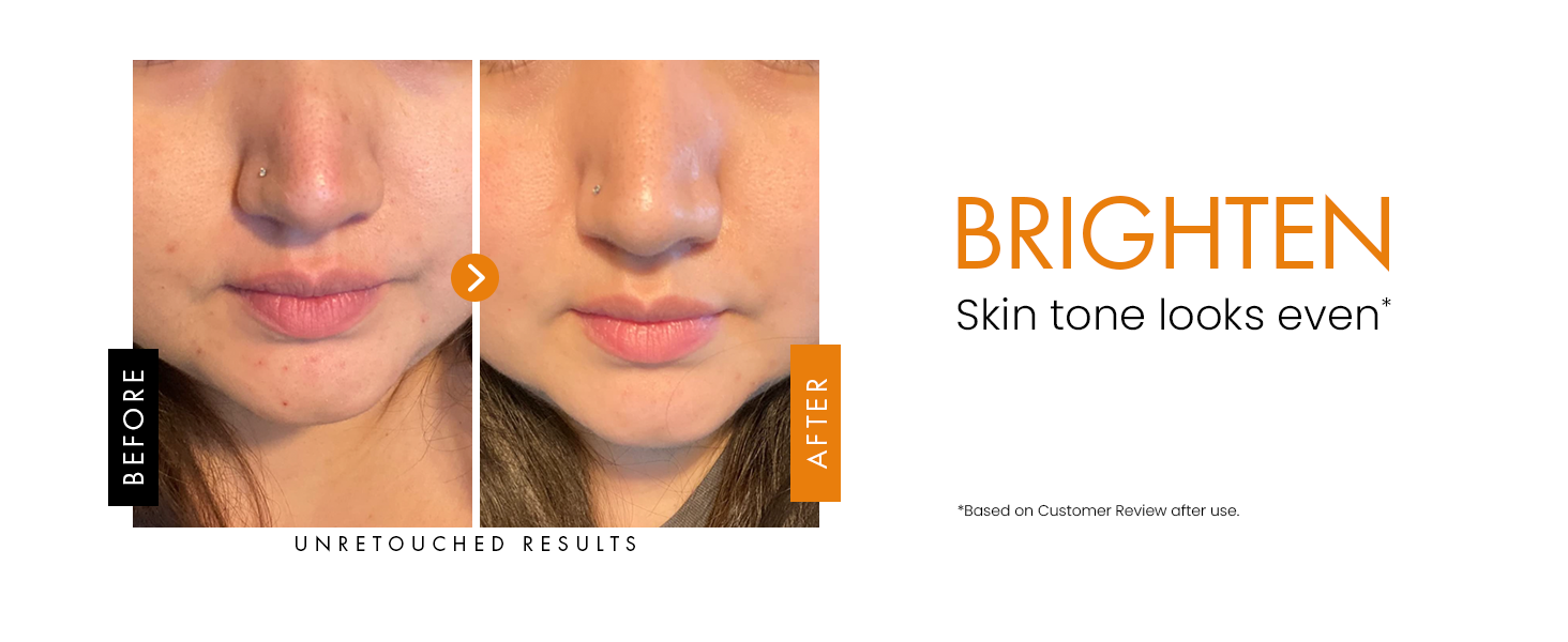vitamin c serum