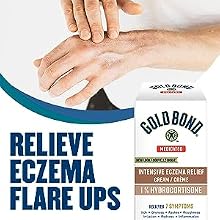 Relieve Eczema Flare Ups
