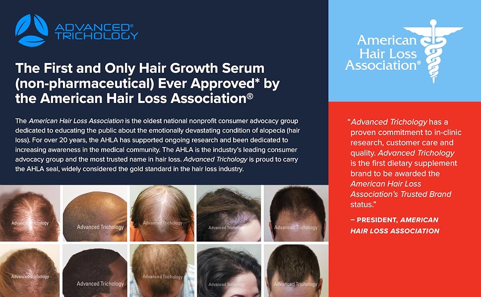 Nutra M Topical Hair Loss Serum