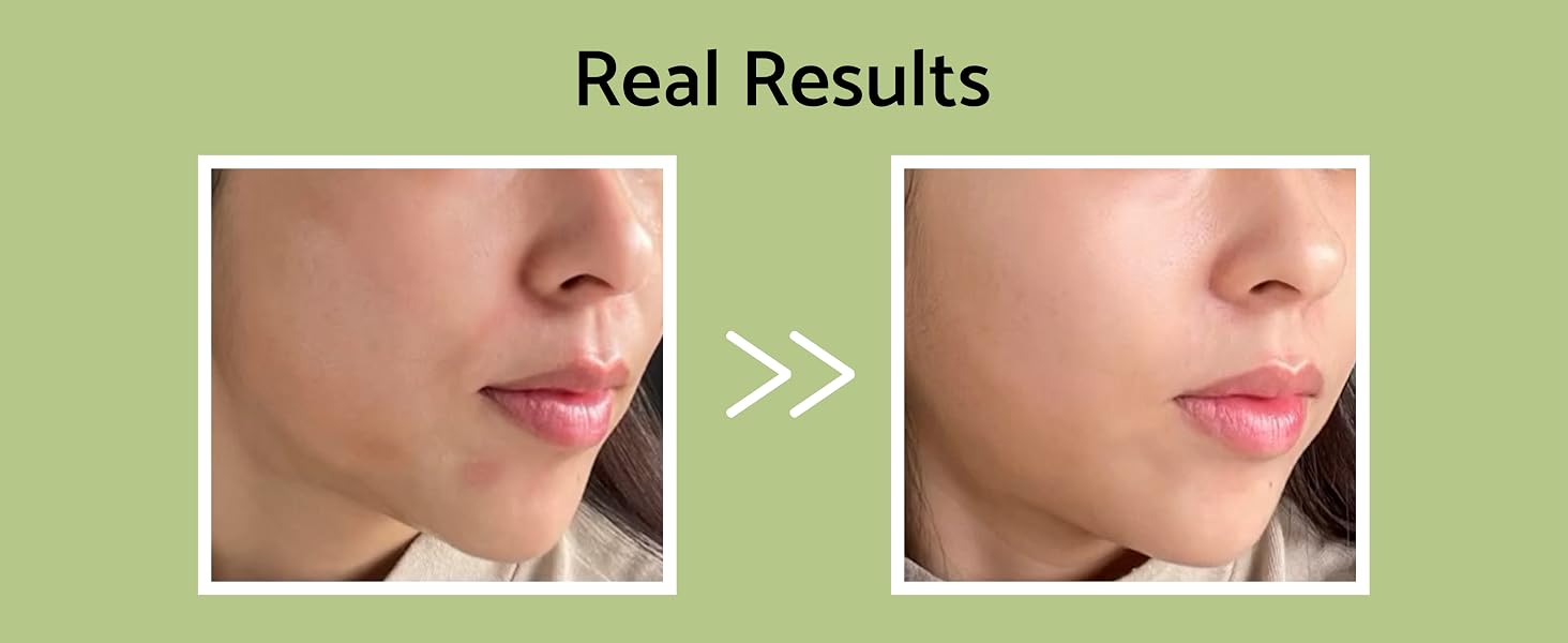 Visible Improvements After Regular Use Clear Radiant Glass Glowing Skin