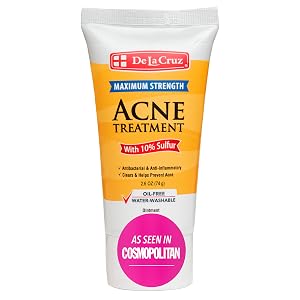 Acne cream spot treatment scar body acne cystic hormonal sulfur ointment de la cruz mask zit pimple